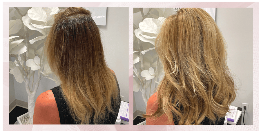 Non Surgical Hair Replacement Wilde Hair Boston MA